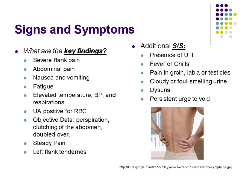 Signs and Symptoms What are the key findings? Severe flank pain  Abdominal pain